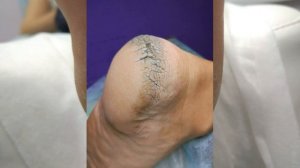 Подология и подолог Нойлингер Оксана