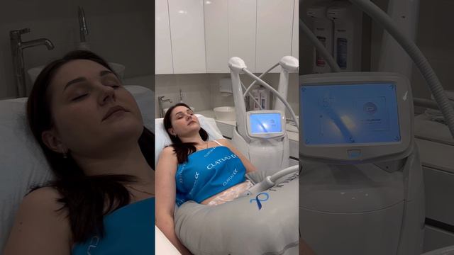 Что такое криолиполиз? Криолиполиз CLATUU - как проходит процедура? | клиника косметологии GEN87 смотреть онлайн