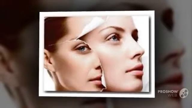 носогубные морщины смотреть онлайн