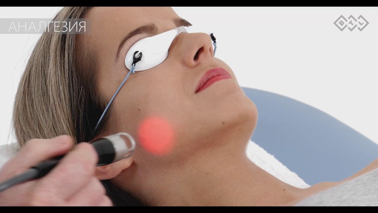 Парез лицевого нерва. Терапевтическое видео: лазер высокой интенсивности BTL-6000 HIL. смотреть онлайн