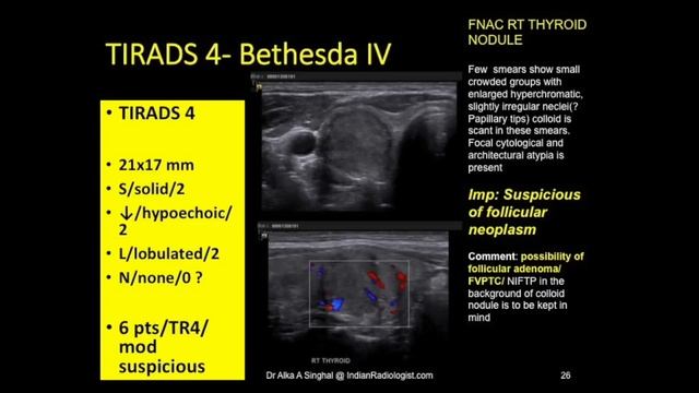 TMT: TIRADS & BETHESDA by Dr Alka Singhal смотреть онлайн