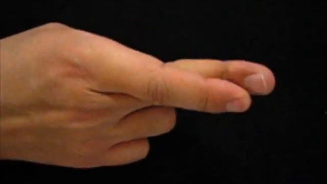 The Cross Finger Sign Test in Hand | Dr Junaid Ahmad Consultant Plastic Surgeon Lahore 03104037071 смотреть онлайн