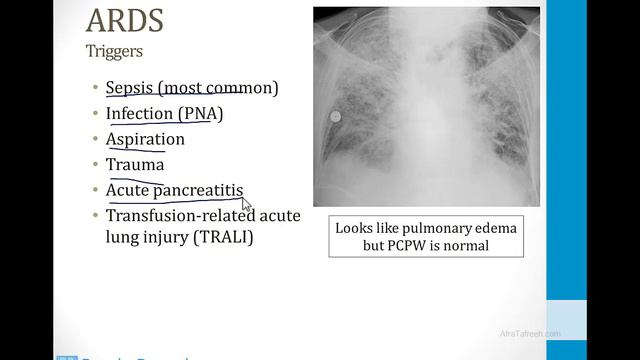 Pulmonary - 3. Other Pulmonary Topics - 1.Pneumonia Atf