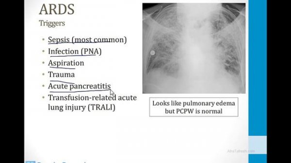 Pulmonary - 3. Other Pulmonary Topics - 1.Pneumonia atf