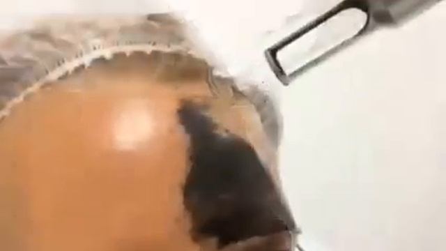 Карбоновый пилинг в Подольске. смотреть онлайн