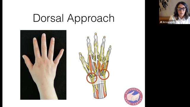 Surgical approaches to hand and fingers by Jill Arrowsmith смотреть онлайн