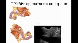 Ультразвуковая анатомия предстательной железы.Видеолекция