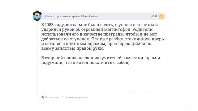 АПВОУТ - Какую историю появления своего шрама вы бы назвали самой глупой? смотреть онлайн