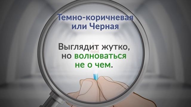 8 цветов ушной серы расскажут о проблемах со здоровьем. Присмотрись! смотреть онлайн