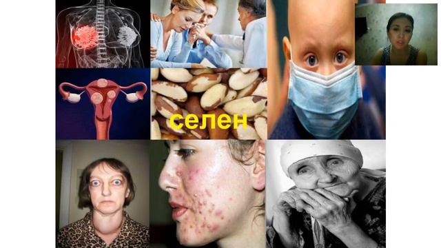 Здоровый образ жизни от Мадины Мамельяновой. Велнес смотреть онлайн