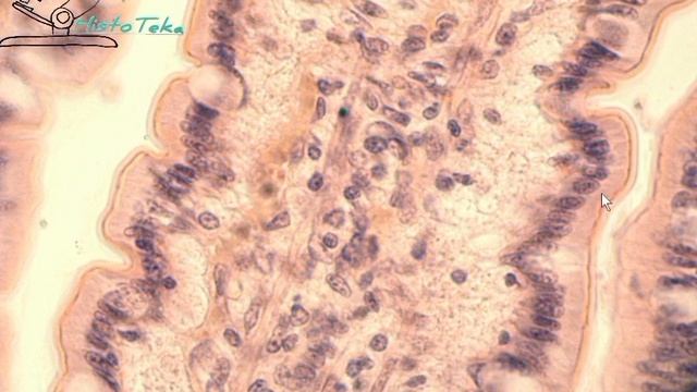 ОДНОСЛОЙНЫЙ ПРИЗМАТИЧЕСКИЙ КАЁМЧАТЫЙ ЭПИТЕЛИЙ смотреть онлайн