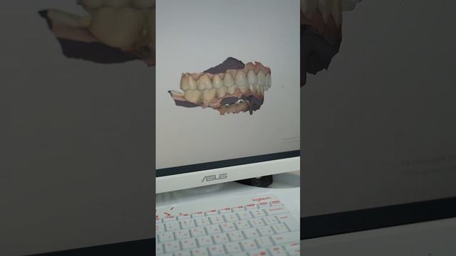 Имплантация и протезирование в Тольятти