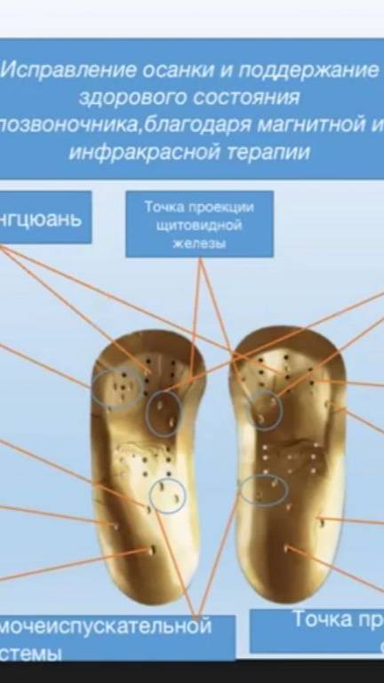 Коррекционные стельки смотреть онлайн