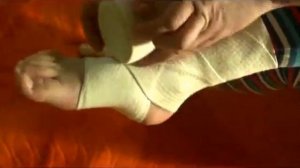Десмургия. Повязка на пятку, голеностопный сустав