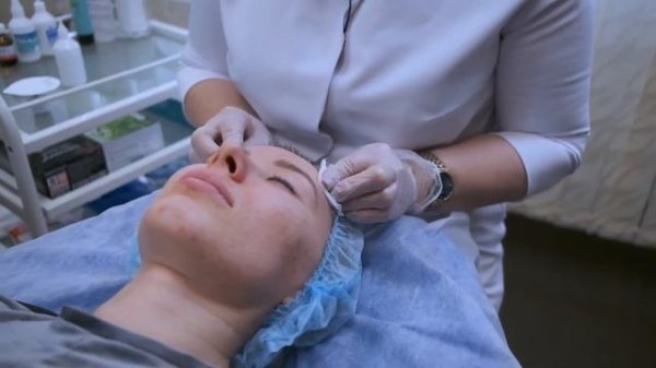 Обзор Игольчатых RF Аппаратов от Ivan Serd Pro. Часть 2.