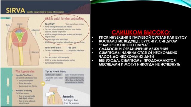 S.I.R.V.A смотреть онлайн