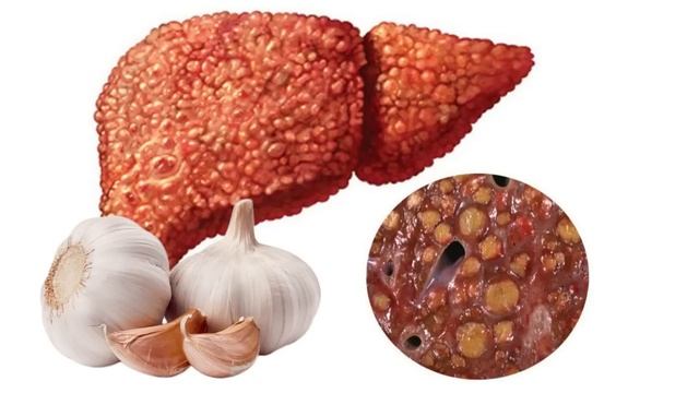 Чеснок -лекарство от Природы - Garlic - Nature's Medicine