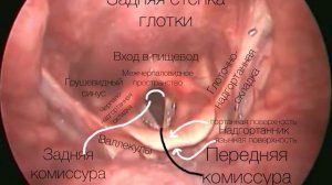 Эндоскопическая анатомия гортани