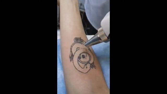 Удаление татуировки в Only you смотреть онлайн