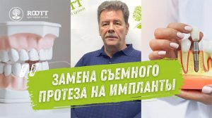 Комплексная имплантация с последующим лечением своих зубов.