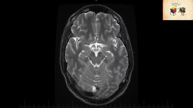 ВЫГОРАНИЕ. Для тех, кто ЛИШИЛСЯ мотивации и сил смотреть онлайн