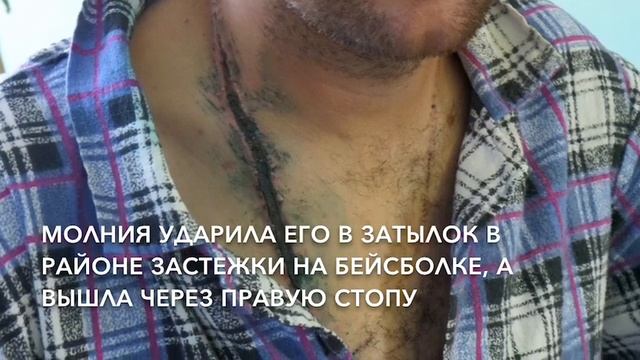 Мужчина, который выжил. В пензенской больнице лечат пациента после удара молнии смотреть онлайн