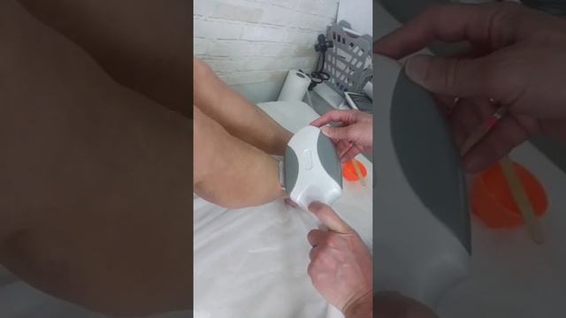 Элос эпиляция голени ног... Светлана Яковенко Оренбург смотреть онлайн