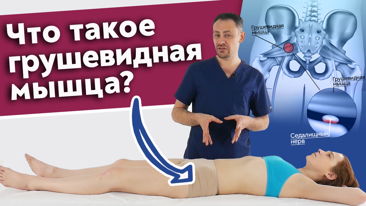 Лечение грушевидной мышцы без операции!
Как избавиться от проблем с грушевидной мышцей?