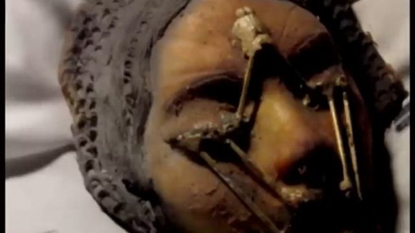 Apollo 20 - Autopsy inside the lunar module "Endymion"