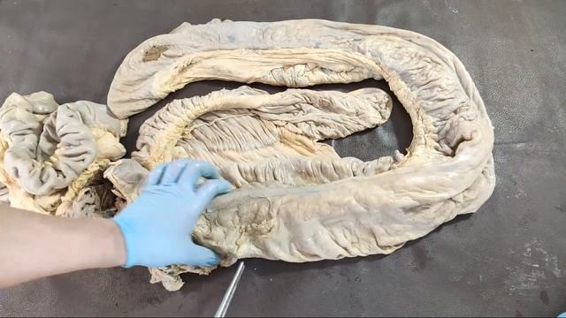 Тонкий и толстый кишечник, печень, поджелудочная железа смотреть онлайн