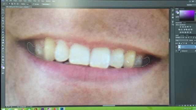 How to whiten teeth in Photoshop смотреть онлайн