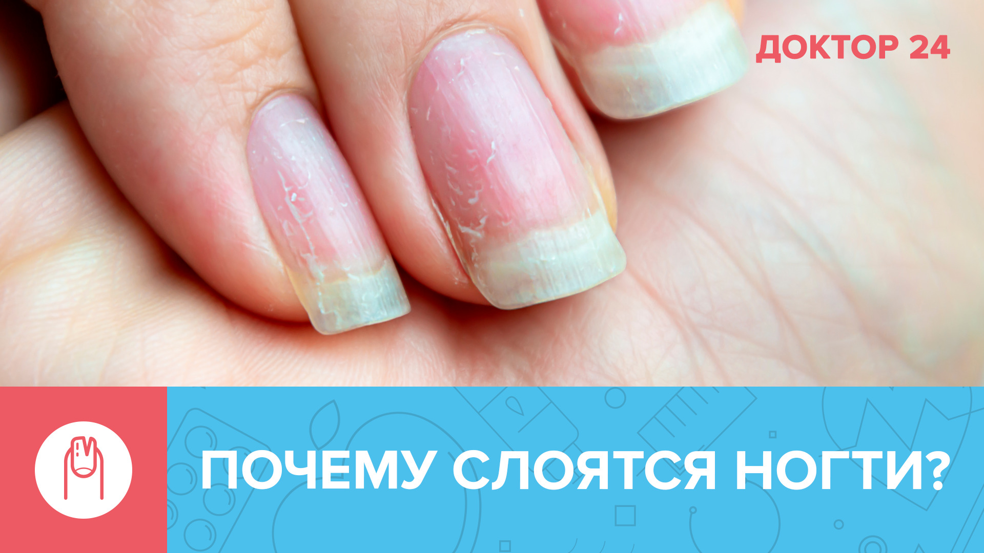 Почему СЛОЯТСЯ НОГТИ: 5 причин, о которых вы не знаете | Доктор 24 смотреть онлайн