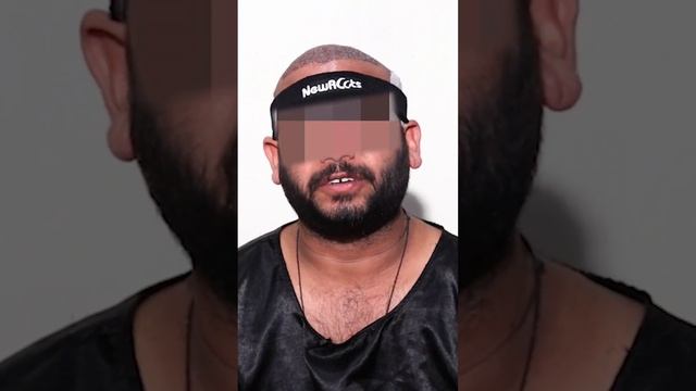 "Fear to Fabulous: New Roots Hair Transplant Experience #hairtransplanthyderabad #hairloss смотреть онлайн