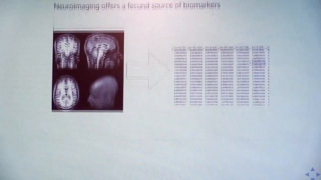 Data Analysis in MRI and PET/MRI Neuroimaging - Davide Poggiali смотреть онлайн