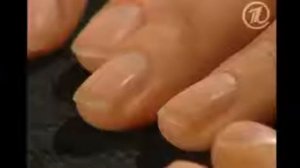 Диагноз по ногтям