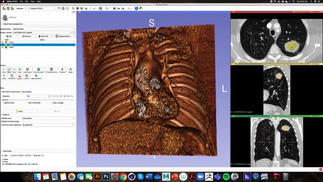 3D Slicer - Segment Editor and Segmentations смотреть онлайн