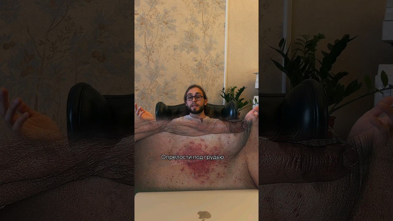 хватит это терпеть ! решение есть, смотри до конца ) #пластическийхирург