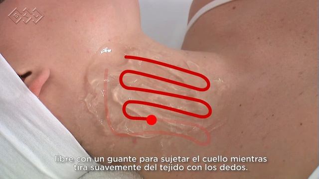 BTL Exilis Elite VIDEO neck ES100 смотреть онлайн