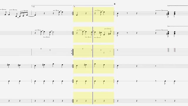 Elvis Presley - Heartbreak Hotel смотреть онлайн