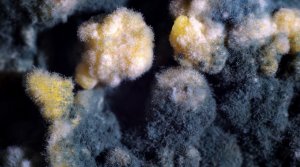 НЕ КОРМИТЕ ГРИБКОВ У СЕБЯ В ОРГАНИЗМЕ лечение грибка