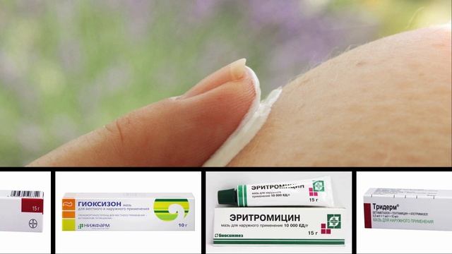 Как Избавиться От Прыщей На Ягодицах смотреть онлайн