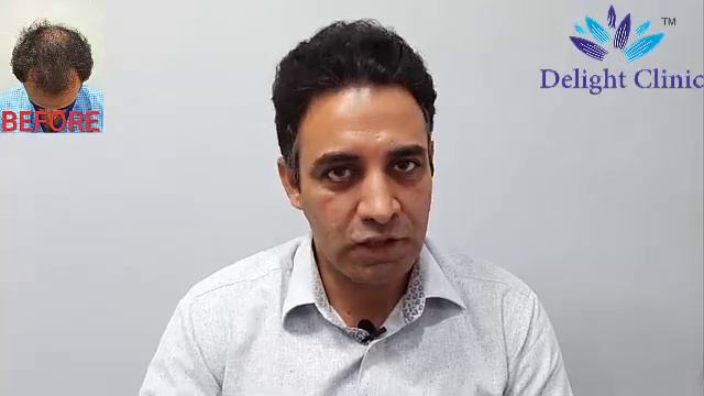 Feedback of our client after his hair transplant procedure. смотреть онлайн