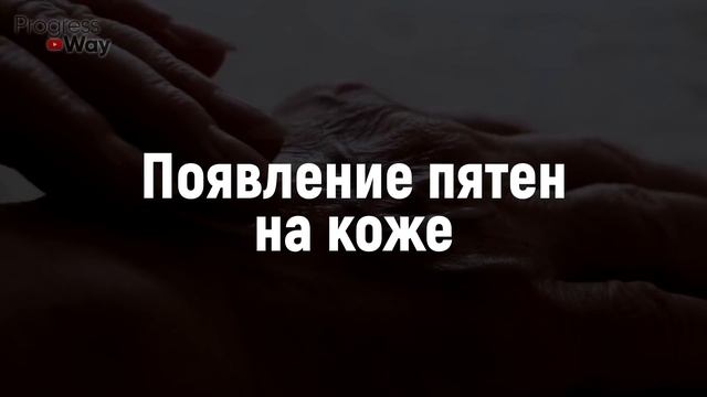10 Ранних Признаков Что у Вас ДИАБЕТ. Большинство Игнорируют ЭТО! (Профилактика диабета)
