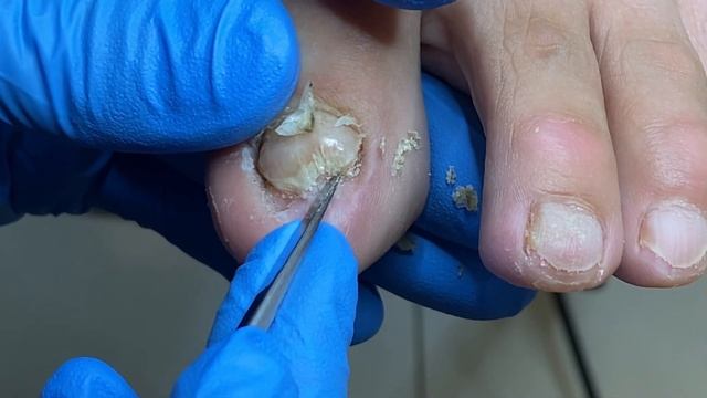 Manicure: How To Trim Hard Nails【辥一刀】