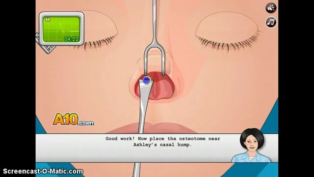 Girls Go Games - Nose Surgery смотреть онлайн