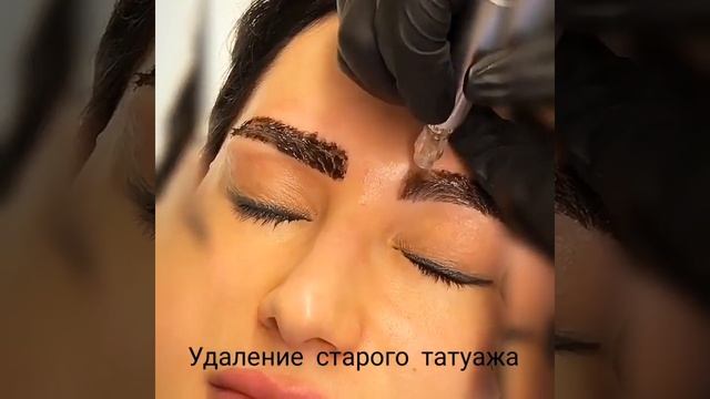 Удаление перманентного макияжа ремувером смотреть онлайн