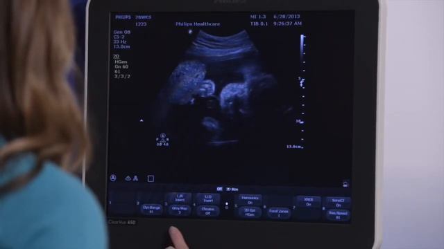 Philips Clearvue 650 Ultrasound Knobology Training Part 2 смотреть онлайн
