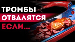 САМАЯ БЫСТРАЯ СМЕРТЬ! / Как тромб УБИВАЕТ МИЛЛИОНЫ людей?