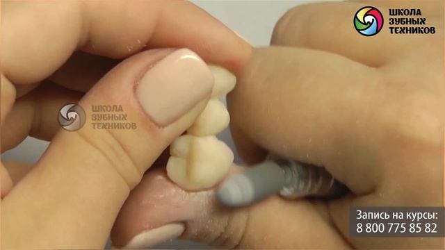 5) Временные коронки. Часть 3 смотреть онлайн