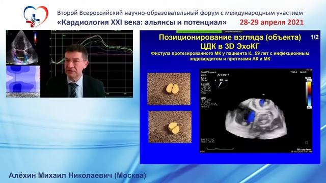 Алёхин М.Н. (Москва). смотреть онлайн